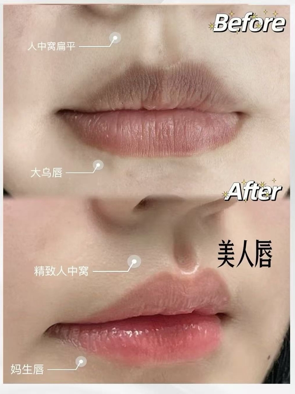 美人唇